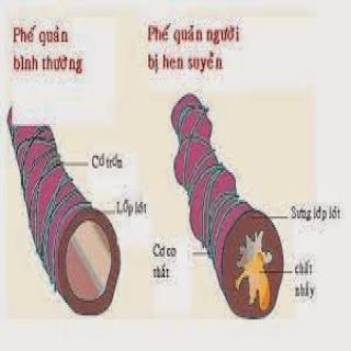 Tác dụng của Đông Trùng Hạ Thảo với bệnh hen suyễn