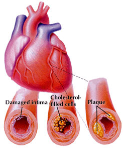 Làm giảm cholesterol trong máu